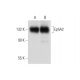 western blotting image from recommended EphA2 (C-3) monoclonal antibody replacement. Image 318454