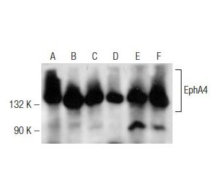 western blotting image from recommended EphA4 (D-4) monoclonal antibody replacement. Image 141698
