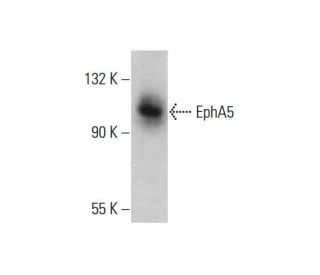 western blotting image from recommended EphA5 (8B10B1) monoclonal antibody replacement. Image 377464
