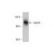 western blotting image from recommended EphA5 (8B10B1) monoclonal antibody replacement. Image 377464