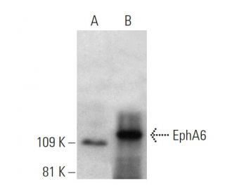 EphA6 Antibody (1426CT591.205.91.119) - Western Blotting - Image 374602