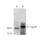 EphA6 Antibody (1426CT591.205.91.119) - Western Blotting - Image 374602