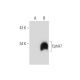 western blotting image from recommended EphA7 (E-7) monoclonal antibody replacement. Image 299442