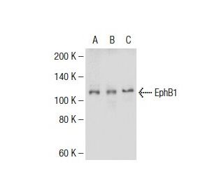 western blotting image from recommended EphB1 (5F10A4) monoclonal antibody replacement. Image 137466