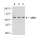 Cet anticorps polyclonal n'est plus commercialisé. Voir l'anticorps monoclonal <a href="ephb1-antibody-5f10a4">EphB1 (5F10A4)</a> que nous recommandons (données d'échantillonnage indiquées). western blotting image from recommended EphB1 (5F10A4) monoclonal antibody replacement. Image 137466