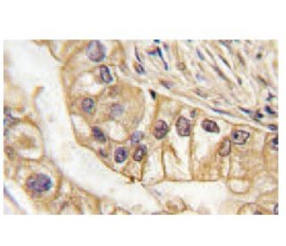 EphB2 Antibody (48CT12.6.4) - Immunohistochemistry - Image 57149 