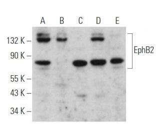 western blotting image from recommended EphB2 (2D12C6) monoclonal antibody replacement. Image 362400