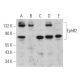 Este anticuerpo policlonal ha dejado de fabricarse. Consulta nuestro anticuerpo monoclonal recomendado <a href="ephb2-antibody-2d12c6">EphB2 (2D12C6)</a> (se muestran datos de muestra). western blotting image from recommended EphB2 (2D12C6) monoclonal antibody replacement. Image 362400