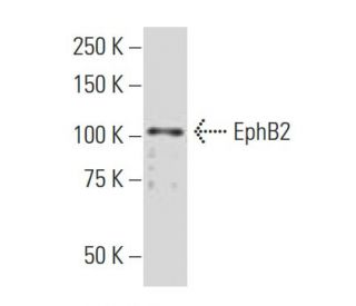 EphB2 Antibody (SY4) - Western Blotting - Image 33672