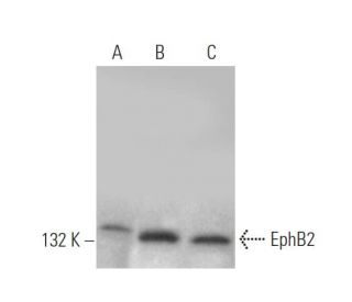 EphB2 Antibody (48CT12.6.4) - Western Blotting - Image 374613 