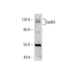 EphB3 Antibody (7E5) - Western Blotting - Image 32814 