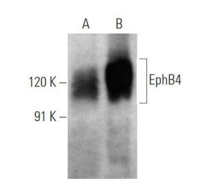 EphB4 Antibody (5G2F8) - Western Blotting - Image 356303 