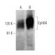 EphB4 Antibody (5G2F8) - Western Blotting - Image 356303 