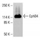 EphB4 Antibody (5G2F8) - Western Blotting - Image 413395