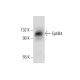 EphB4 Antibody (H-10) - Western Blotting - Image 303848