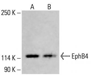 EphB4 Antibody (H-10) - Western Blotting - Image 414314 