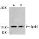 EphB4 Antibody (H-10) - Western Blotting - Image 414314 