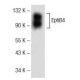 Este anticuerpo policlonal ha dejado de fabricarse. Consulta nuestro anticuerpo monoclonal recomendado <a href="ephb4-antibody-h-10">EphB4 (H-10)</a> (se muestran datos de muestra). western blotting image from recommended EphB4 (H-10) monoclonal antibody replacement. Image 141765