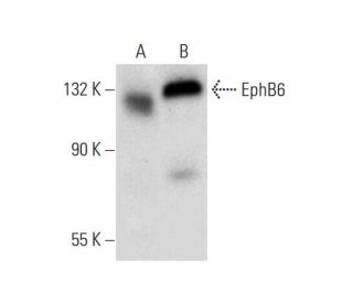 western blotting image from recommended EphB6 (D-7) monoclonal antibody replacement. Image 308461