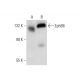 western blotting image from recommended EphB6 (D-7) monoclonal antibody replacement. Image 308461