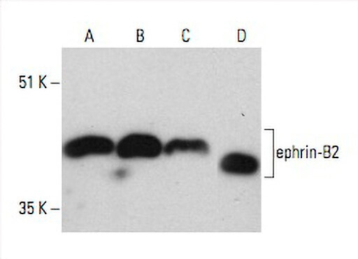 Anti-ephrin-B2 Antibody (F-2) | SCBT - Santa Cruz Biotechnology