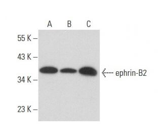 western blotting image from recommended ephrin-B2 (F-2) monoclonal antibody replacement. Image 308154