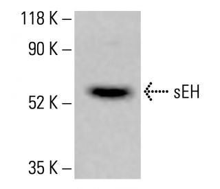 sEH Antibody (A-5) - Western Blotting - Image 413841
