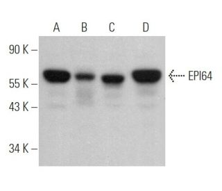 EPI64 Antibody (B-9) - Western Blotting - Image 369452Each CRISPR/Cas9 Knockout (KO) Plasmid product consists of a pool of 3 plasmids designed to ensure identification and cleavage of a specific gene for maximum knockout efficiency. Each plasmid encodes a unique 20 nt sequence derived from the GeCKO (v2) library.