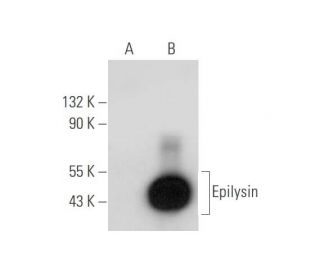 Epilysin Antibody (F-10) - Western Blotting - Image 333696