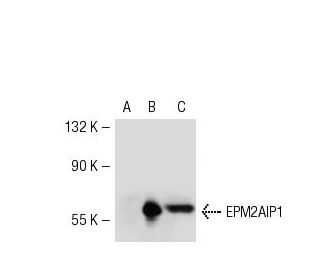 EPM2AIP1 Antibody (YS-62) - Western Blotting - Image 53294