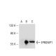 EPM2AIP1 Antibody (YS-62) - Western Blotting - Image 53294
