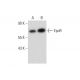 Este anticuerpo policlonal ha dejado de fabricarse. Consulta nuestro anticuerpo monoclonal recomendado <a href="epor-antibody-d-5">EpoR (D-5)</a> (se muestran datos de muestra). western blotting image from recommended EpoR (D-5) monoclonal antibody replacement. Image 147522