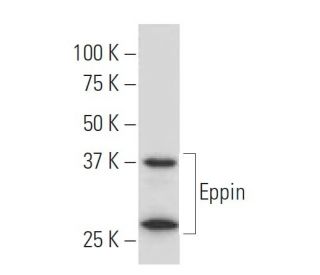 Eppin Antibody (YY-23) - Western Blotting - Image 34099