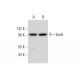 Eps8 Antibody (D-4) - Western Blotting - Image 306582 