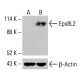 Eps8L2 Antikörper (F-8): sc-514673. Western Blot Analyse der Eps8L2 Expression in unbehandelten (A) und chemisch behandelten (B) HCT-116-Ganzzelllysaten. Verwendetes Nachweisreagenz: m-IgG2b BP-HRP: sc-542741. β-Actin (C4): sc-47778 als Ladekontrolle verwendet. Verwendetes Nachweisreagenz: m-IgG Fc BP-HRP: sc-525409. Eps8L2 Antibody (F-8) - Western Blotting - Image 415699