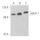 Dieser polyklonale Antikörper wird nicht mehr hergestellt. Wir empfehlen Ihnen unseren <a href="epsin-1-antibody-c-11">epsin 1 (C-11)</a> monoklonalen Antikörper (Beispielsdaten werden angezeigt). western blotting image from recommended epsin 1 (C-11) monoclonal antibody replacement. Image 355710