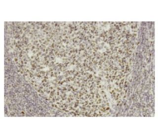 EPSTI1 Antibody (ZZ4) - Immunohistochemistry - Image 36110 