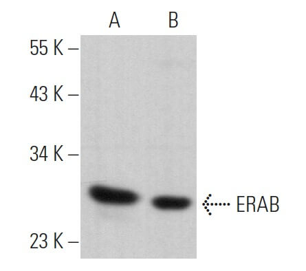 ERAB Antibody (E-10) | SCBT