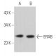 ERAB Antibody (F-1) - Western Blotting - Image 366493 