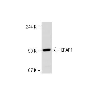 ERAP1 Antibody (731) - Western Blotting - Image 53302 