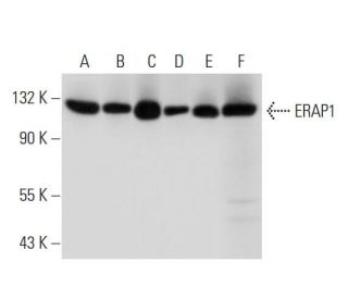 ERAP1 Antibody (B-10) - Western Blotting - Image 305903 