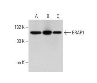 ERAP1 Antibody (B-10) - Western Blotting - Image 305902
