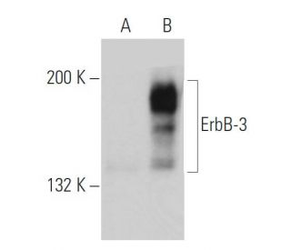 ErbB3/HER3 Antibody (2Q320) - Western Blotting - Image 38481