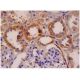 ErbB3/HER3 Antibody (SGP1) - Immunohistochemistry - Image 287318