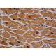 ErbB4/HER4 Antibody (3F168) - Immunohistochemistry - Image 357578