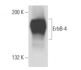 ErbB4/HER4 Antibody (3F168) - Western Blotting - Image 18095 