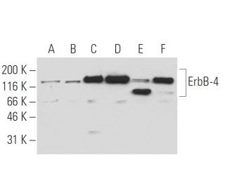 ErbB4/HER4 Antibody (6C5) - Western Blotting - Image 62901