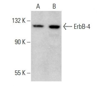 western blotting image from recommended ErbB4/HER4 (C-7) monoclonal antibody replacement. Image 376090