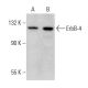 western blotting image from recommended ErbB4/HER4 (C-7) monoclonal antibody replacement. Image 376090