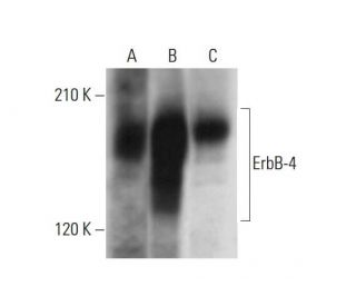 ErbB4/HER4 Antibody (G-6) - Western Blotting - Image 320249 